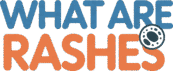 What Are Rashes