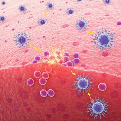 Microscopic view of skin cells reacting to an allergen with histamine release